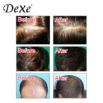 dexe-hair-building-fibers-22g-3
