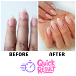 milano-plus-nail-treatments-before-after