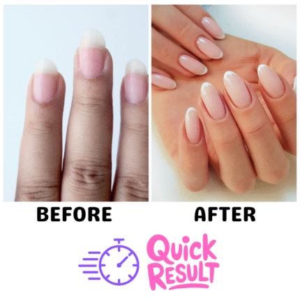 milano-plus-nail-treatments-before-after
