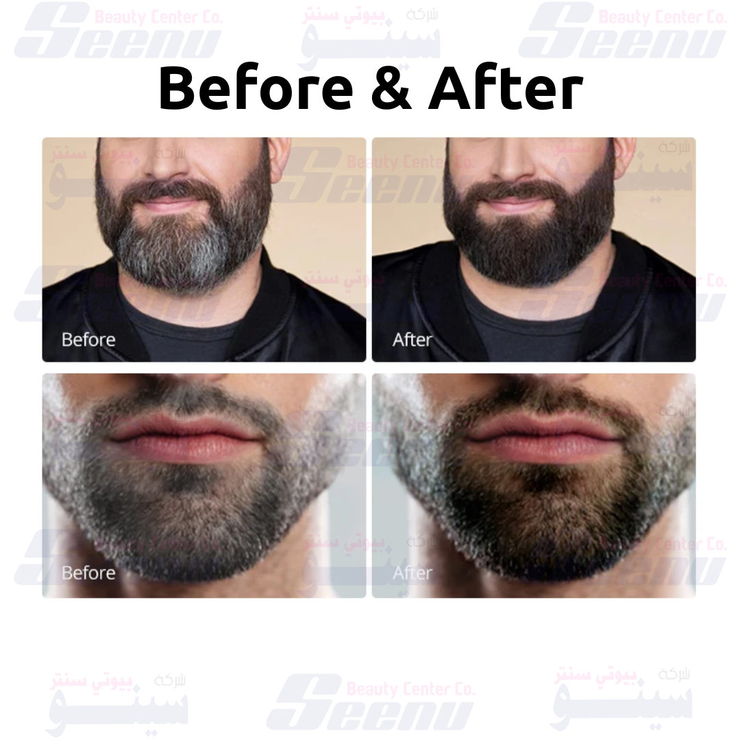 Disaar Beard Color Cream Mens before after disaar-beard-color-cream-mens-natural-black-4