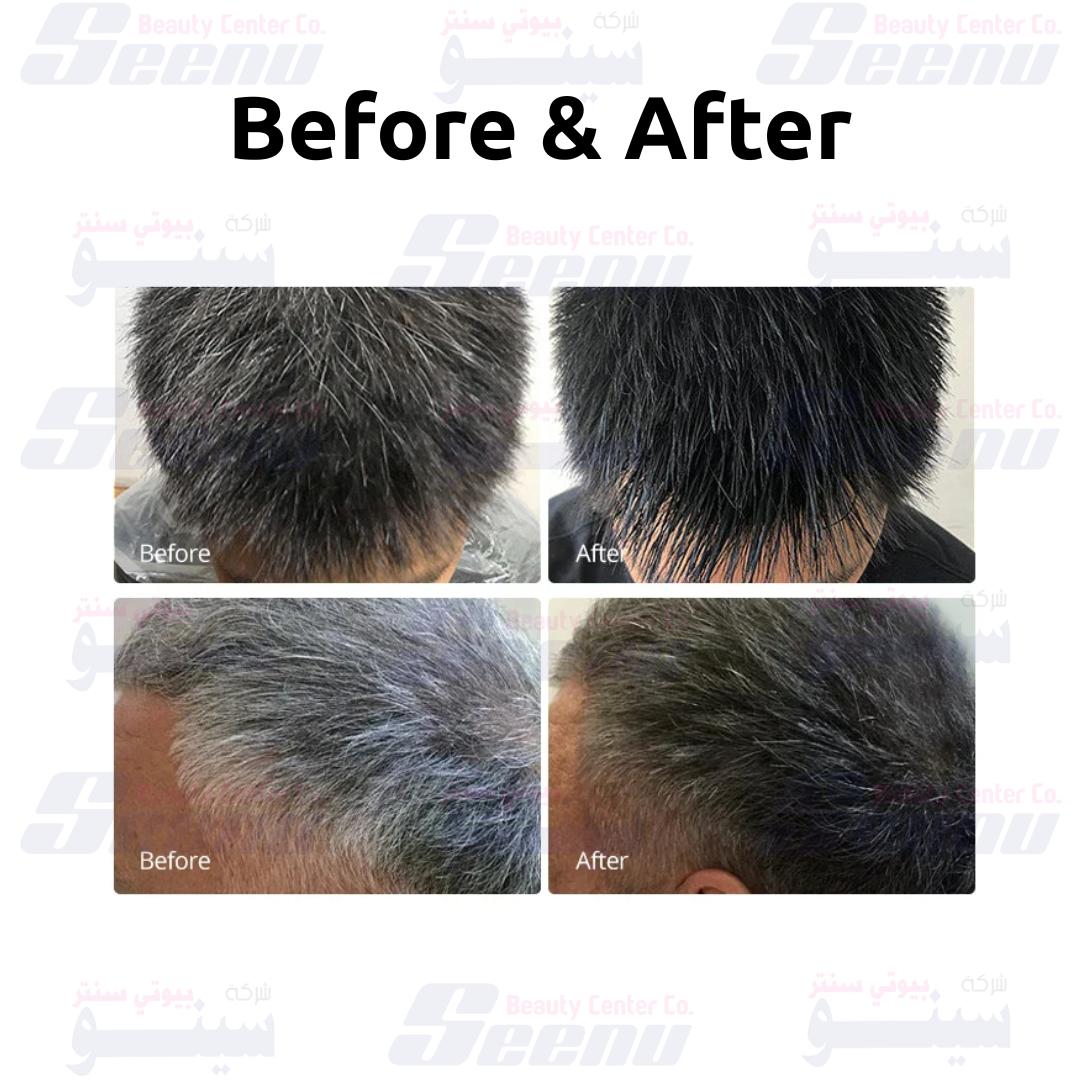 Disaar Hair Color Cream Mens before after disaar-hair-color-cream-mens-natural-black-before-after